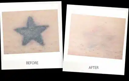 We offer advanced energy-based and injectable treatments that target various skin concerns