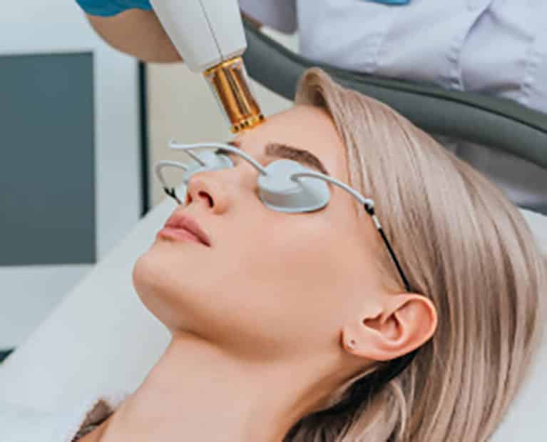 IPL Laser Treatments: Clear Skin Without Downtime