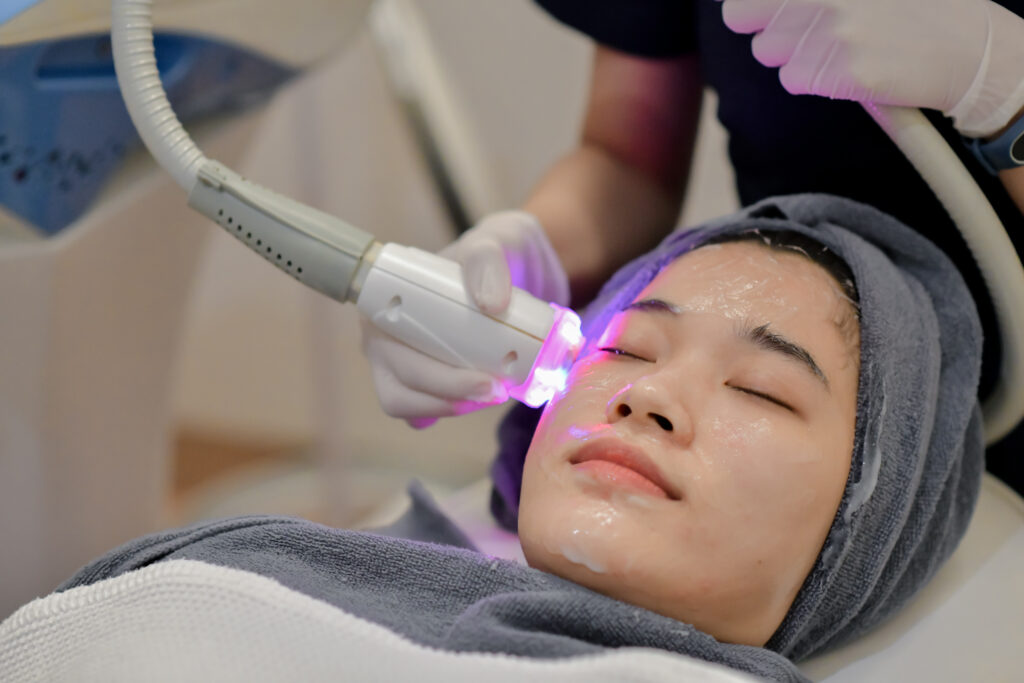OPUS Fractional Plasma Resurfacing