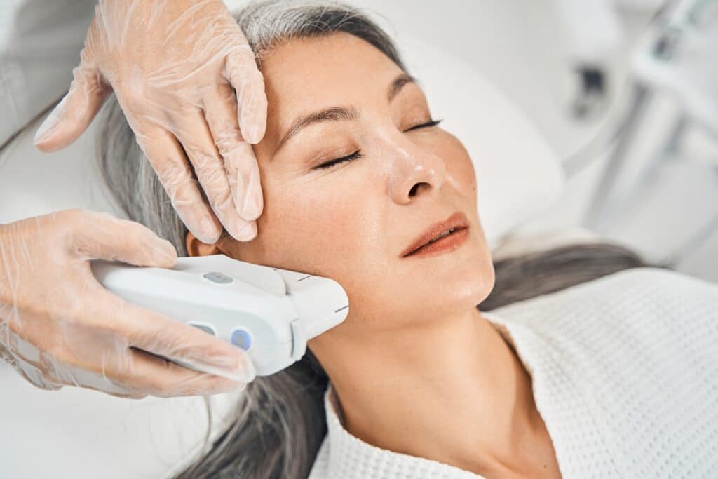 IPL Laser Treatment in Clewiston, FL