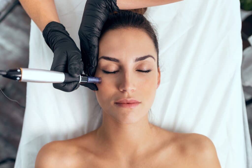 Microneedling Treatments in Clewiston & Labelle