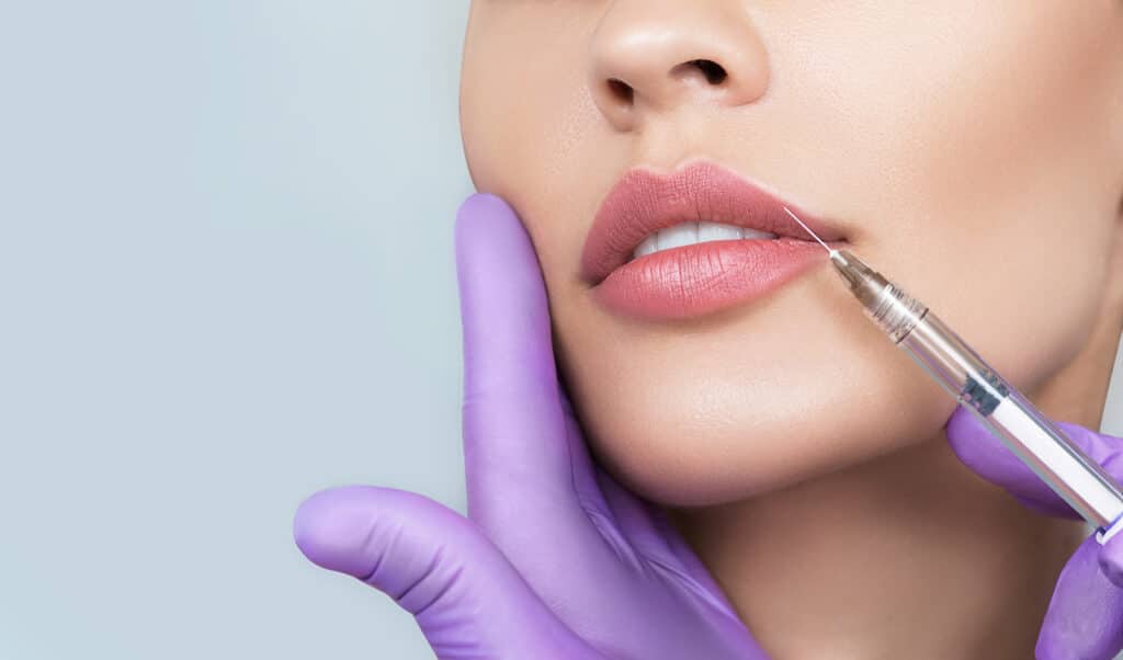 Restylane Hyaluronic Acid Fillers