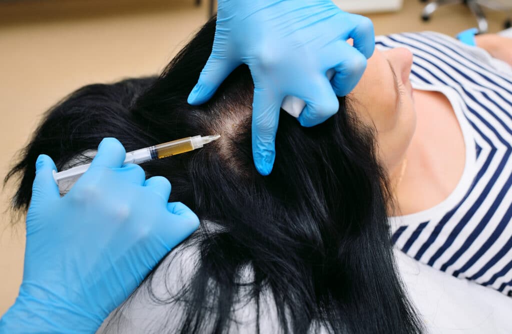 TED Hair Restoration