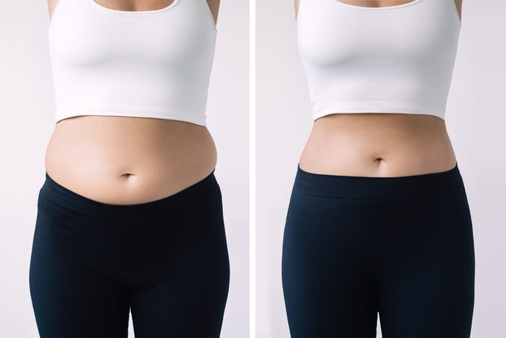 GLP-1 Weight Loss Injections